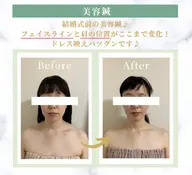 【美容鍼】90分リピーター様回数券