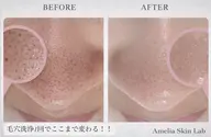 【新生活応援】毛穴洗浄+艶肌Wax（全顔）+鎮静ケア