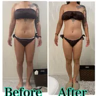 上半身or下半身🔥madoka式徹底痩身💕ハイパーナイフ20分✖️針を使わない脂肪撃退10ml💉