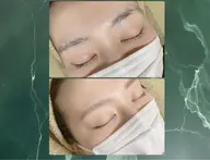眉毛の形にお悩みの方◎眉毛デザインWAX脱毛 お試し1回