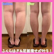 インディバ越えの機器で短期集中結果重視🔥韓国アイドル美脚に持っていく💎むくみセルライトを撃退.ᐟ