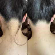 【女性】うなじ脱毛🫧¥4,980 ワックス脱毛✖️光脱毛でうなじ美人👰‍♀️ブライダル・イベント前にも🙆‍♀️