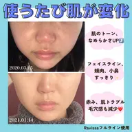 【ホームケア・スキンケアアドバイス】 💎美肌効果が高く、お肌の土台から整え透明感がUP⤴︎するラヴィーサ化粧品使用🌸