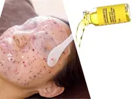 圧倒的人気🍋【小顔.毛穴.顔の脂肪ケア】れもんボトル2ml+ハイドロジェリーマスク‼️¥33000→¥23100