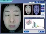 美肌ドック（お肌診断）