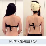 【ご新規様限定25%OFF】お好きな箇所をしっかりと✨トリプル溶解痩身90分