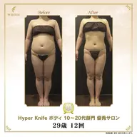 結果重視:痩身&小顔リフト]ハイパー痩身orコルギ小顔[120分]