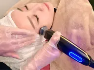 【お顔の脂肪、たるみケア】切らない瞬間リフトアップ