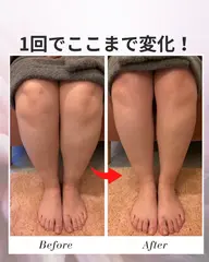 脚が太い原因、“むくみ放置”かも？脚集中コース