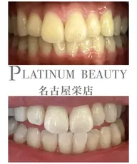 【当店オススメ！本気で白くしたい方へ】　プレミアムセルフホワイトニング✨〈2来店合計70分〉