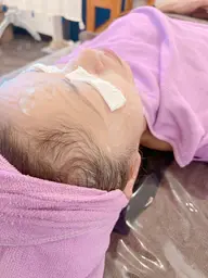 🈹🈹🉐𓆉シミ！ニキビの方はまずこれ！！■レストトリートメント