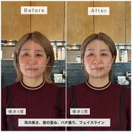 【贅沢小顔ケア】ととのう骨格補正スパ＋内部補修Xトリートメント