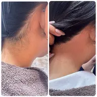 【女性限定】【うなじ】ワックスで産毛をしっかり取り除き、首が長く・細く見えるスッキリした印象に✨