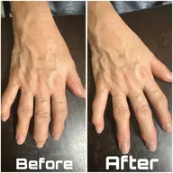 【手元から若々しく✨】スペシャルハンドケア🌿ネイルケア込。EMS×オイルで手のエイジングケア!ツヤのある理想の手元へ