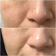 《ハリ不足/たるみケア》エンビロン・エイジングケアコース🍋モニター募集