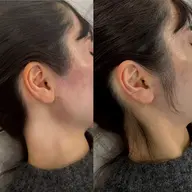 お着物set👘💕うなじ✨もみあげ✨Wax脱毛🎁