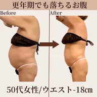 【上半身☆痩身】脱・おばさん体型！Tシャツが似合うボディに♪更年期にも◎お腹/二の腕/背中《初回限定💫特別価格》