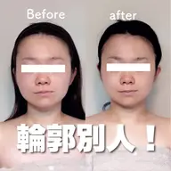 【人気No.1】12/11限定メニュー！整形級小顔へ！！ヘッドスパ＋オーダーメイド小顔矯正＋小顔オイルリンパ