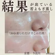 結果が出ている若よもぎ蒸し🌿‬温まるだけじゃない！蒸されるだけでお肌が綺麗に✨全身美容のよもぎ蒸し🧙‍♀️🌿‬