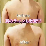 最新機器痩身エステ❤️‍🔥BODY90分❤️‍🔥＋ヒートマット10分❣️キャビ＋ラジオ派＋スリムレーザー＋LED🫶