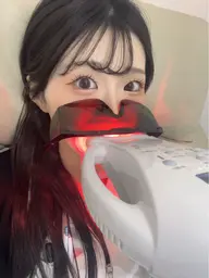 🟥1番人気🌟Aコース🟥《初回40%OFF🉐》 10分＋13分＋赤色20分/3回照射ホワイトニング