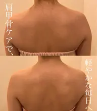 肩こりさん必見当店リピート率No1