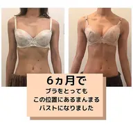 【初回限定】女性ホルモンを整えるバストケア、PMSや生理痛でお悩みの方にも