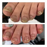 【フットトータルケア】足爪10本、足裏踵角質ケア、フットリフレ