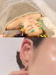 【耳ツボジュエリー👂💎＋電気美容鍼】お体の不調は耳ツボで！（学割500円OFF）