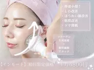 【インモードリフト】