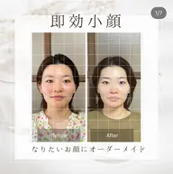 速攻小顔オーダーメイド100分