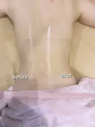 身体の芯から温め痩せ体質へ★深部加温ラジオ波筋膜リリース