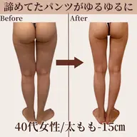 【下半身☆痩身】諦めてたパンツがゆるゆるに♪下半身太り解消◎痩せない太もも/お尻/前ハリ/横ハリ《初回限定💫特別価格》