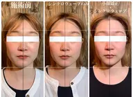 🌟人気No.1🌟破格限定57%off🍀小顔矯正 × ヘッドスパ × シンクロウェーブ🍀90分