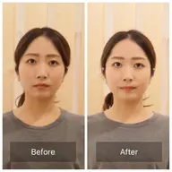 ｟🌼期間限定🌼口コミ投稿募集｠顔の歪み＋小顔整体・姿勢調整【50分15200→0円】