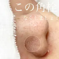 【 天然の水光肌になれる】本格ラボーテ式毛穴エクストラクションプロ