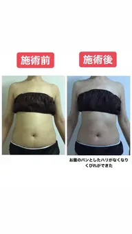 【お試し3回コース】フェイシャル、ボディコースどちらか90分3回48000円→29800円