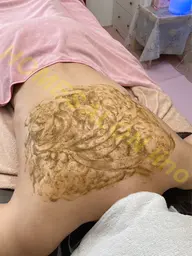 背中の塗る金の糸★(剥けないハーブピーリング🌿‬)              背中ニキビ、背中ケア、ブライダルにも🫶