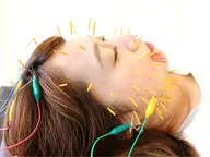 【初回】プレミアム美容鍼（カウンセリング込）