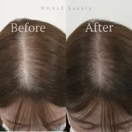 【スキャルプアート】《印象改善》生え際・分け目カバー施術¥55000 → ¥22000