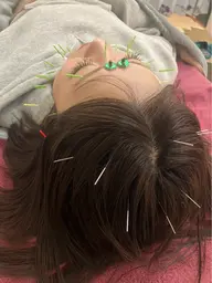 ミニモ学割🧑🎓痛くない小顔美容鍼✨初めての方にもオススメ※メイクされたままでもOK☆