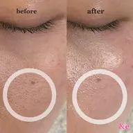 全顔フェイシャルワックス※必ずメニュー内容を確認後にご予約ください