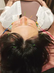 💆‍♀️美容鍼🪡＋ローラ＋肩甲骨剥がしミニモ学割✨