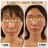 【人気NO.1】小顔ボディ120分　顔に触れずに小顔にする◆全身美容整体【根本改善！美しい小顔・体形をつくる】