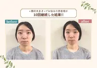 ［初回期間限定価格］小顔整体＋姿勢調整