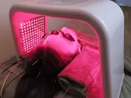 【今月残2名】食いしばりによるエラ張り・たるみを改善したい！美容鍼+LED