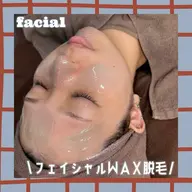 🉐2月限定価格‼️【大人気🔥フェイシャルWax脱毛➕毛穴引き締め保湿パック】メイクのり⭕️産毛レスで浸透力⤴️✨