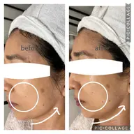 【２回目、3回目ご来店の方】ベーシックフルエステ