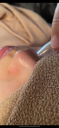 『月曜日限定』毛穴洗浄（祝日の場合翌火曜日対象）