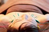 2回目ご利用の方限定‼️【小顔×リフトアップ】むくみ、輪郭、フェイスライン整えるフェイスデザイン美容鍼🪡